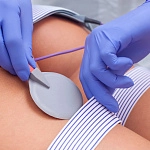 Миостимуляция - Видеокурс Продвинутый (фото)