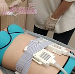 Лазерный липолиз - Видеокурс Продвинутый (фото)